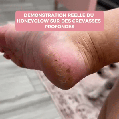 ✨ HoneyGlow™ – Kit Beauté Pieds